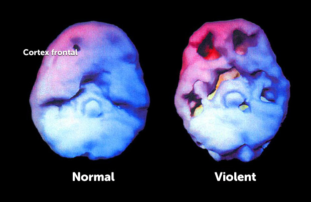 brain-violent-FR