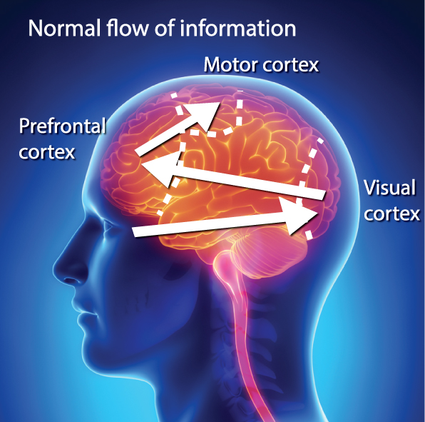 normal-flow